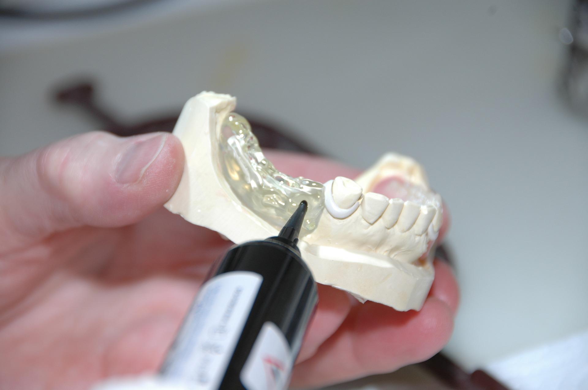 Протезирование зубов в стоматологической клинике
